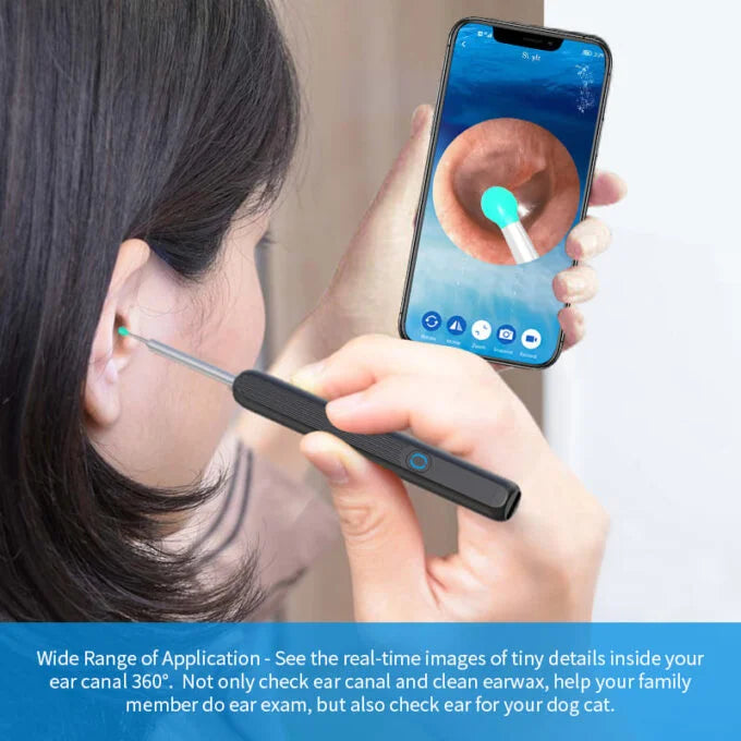 LIMPIADOR DE OÍDOS INTELIGENTE - VE DENTRO DE TU OÍDO Y ELIMINA EL CERUMEN DE FORMA SEGURA⭐⭐⭐⭐⭐